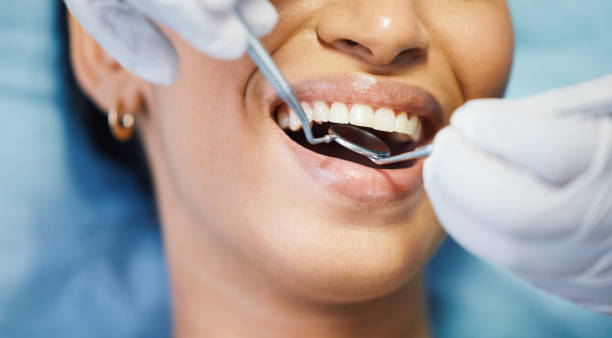 Best Weekend Emergency Dental Services in Vienna, IL
